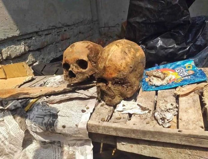 দেওয়ানগঞ্জ বাজারে ময়লার স্তূপে ৫ মানুষের খুলি ও কঙ্কাল উদ্ধার: এলাকায় চরম আতঙ্ক